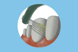 Technology Buletedan